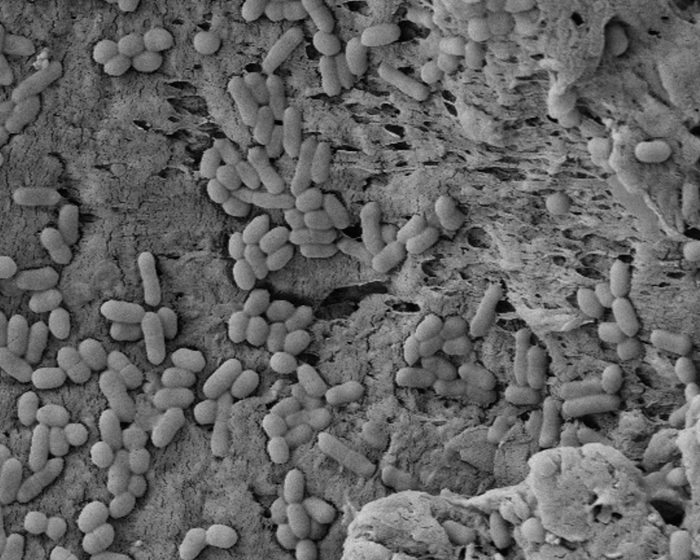 Método biológico para frenar a un patógeno de las heladeras Método biológico para frenar a un patógeno de las heladeras