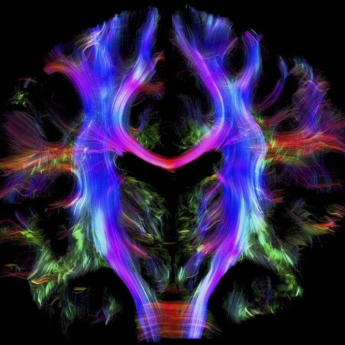 El cerebro y la prevención de enfermedades degenerativas El cerebro y la prevención de enfermedades degenerativas