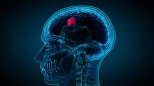 Un análisis de sangre puede predecir el pronóstico en el cáncer cerebral mortal Un análisis de sangre puede predecir el pronóstico en el cáncer cerebral mortal