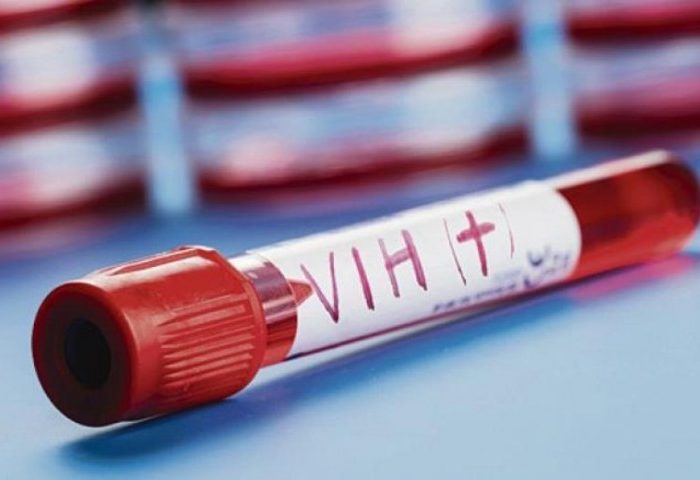 Segundo paciente sin rastro de VIH tras un trasplante de células madre