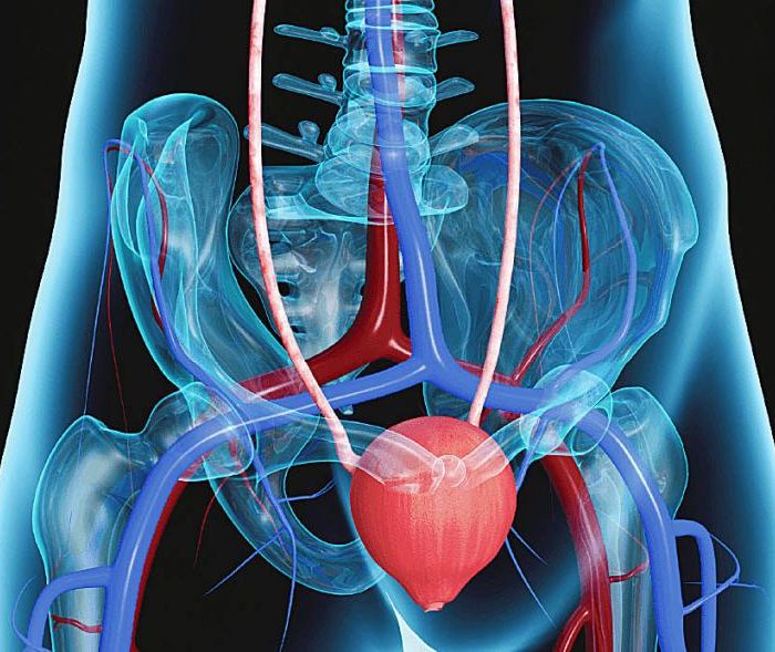 Se diagnosticaron 10 nuevos casos de cáncer de vejiga por día en Argentina