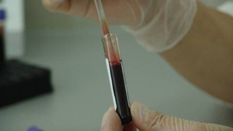 Un análisis de sangre detecta el cáncer 4 años antes que los métodos diagnóstico convencionales