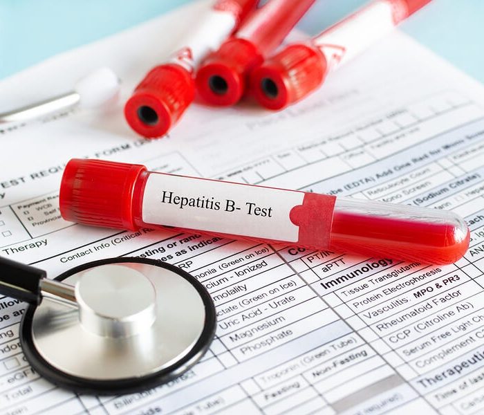 OPS pide mantener la prevención y tratamiento contra las hepatitis durante la pandemia