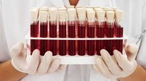 Identifican cinco biomarcadores en sangre que marcan mayor probabilidad de gravedad del COVID-19