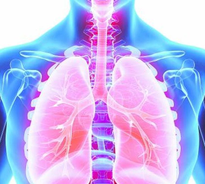 ANMAT aprobó un nuevo tratamiento para cáncer de pulmón ANMAT aprobó un nuevo tratamiento para cáncer de pulmón