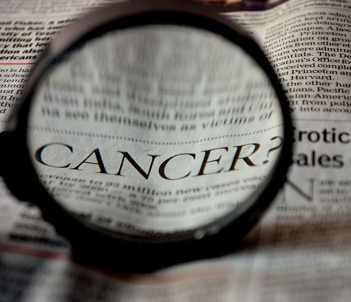El daño acumulado del ADN predice con mucha antelación el riesgo de melanoma El daño acumulado del ADN predice con mucha antelación el riesgo de melanoma