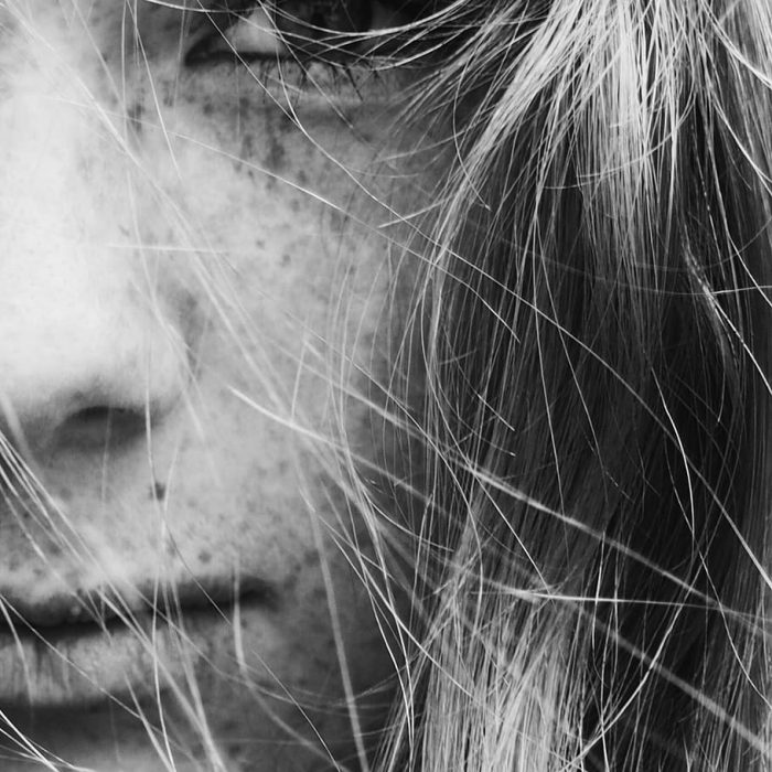 Factores claves para prevenir el cáncer de piel