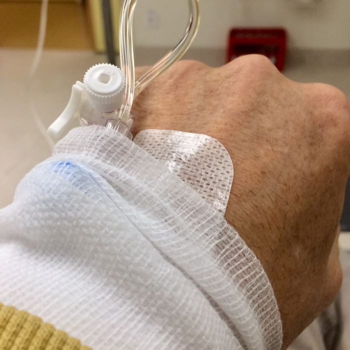 El cáncer de colon detectado tempranamente puede ser curado hasta en un 90%