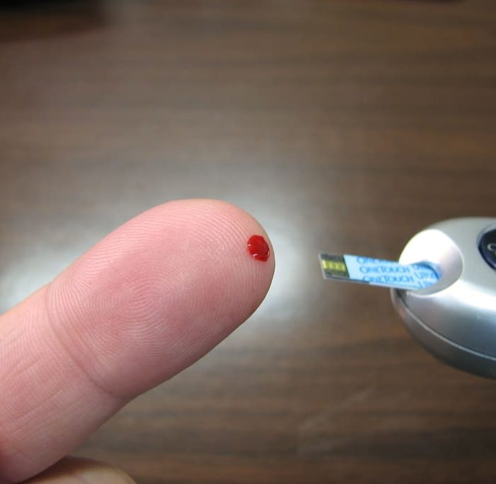 Tener diabetes y llevar una vida plena es posible
