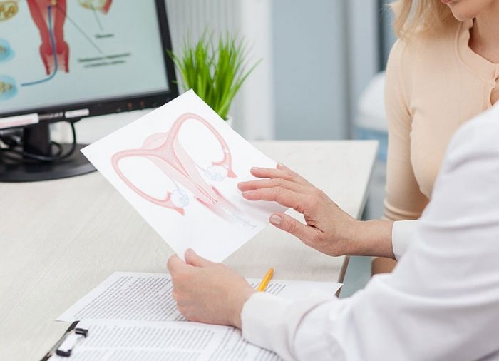 Nuevo tratamiento para pacientes con cáncer de ovario Nuevo tratamiento para pacientes con cáncer de ovario