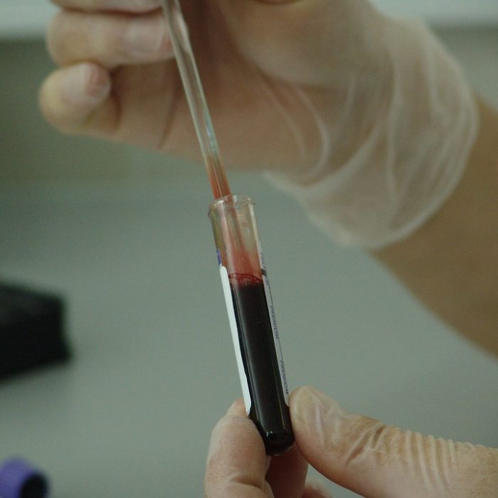 El 70% de los niños que padecieron cáncer se curan