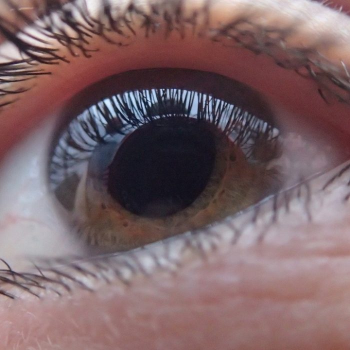 Lo fundamental del diagnóstico temprano del glaucoma