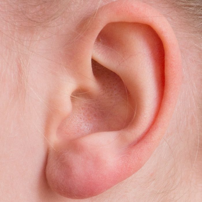 Crecen los casos de otitis media
