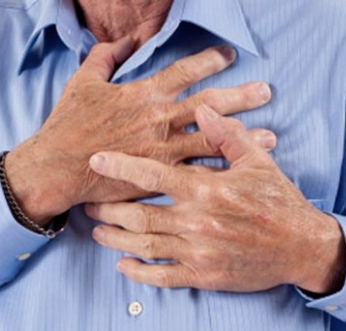 Durante la pandemia, las muertes por infarto agudo de miocardio se incrementaron 15%