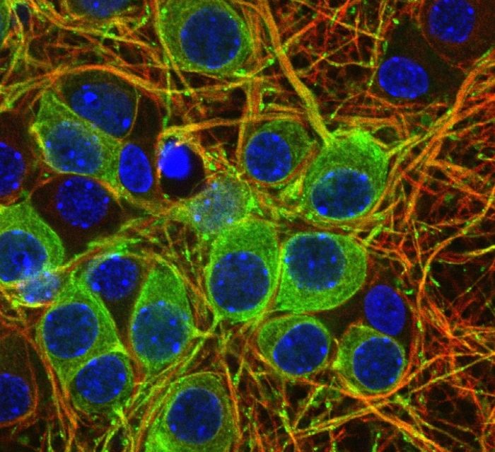 Revelan mecanismos moleculares que jugarían un rol importante en enfermedades neurodegenerativas