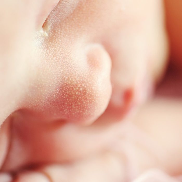 El 95% de los bebés con malformaciones del corazón pueden mejorar su pronóstico