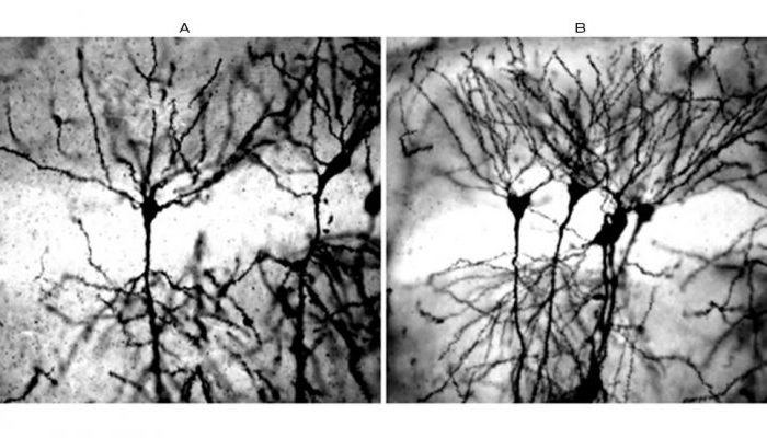 Especialistas del CONICET trabajan en el desarrollo de un fármaco innovador para el tratamiento de enfermedades neurodegenerativas