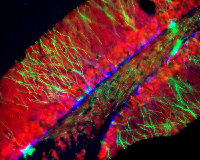 Descubren un mecanismo del cerebro que sería clave para el desarrollo de habilidades socioespaciales