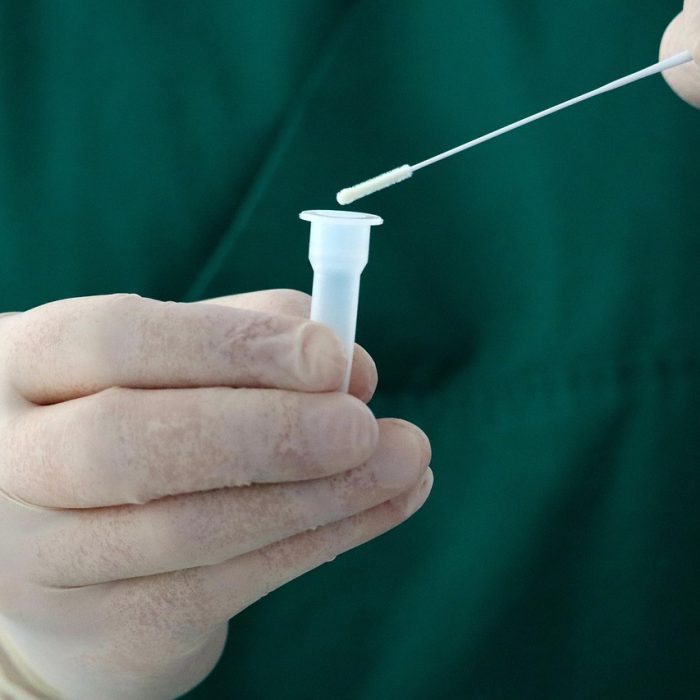 Investigación biomédica promete nuevas vías de tratamiento contra el Covid-19
