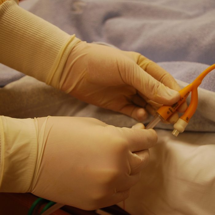 Dan a conocer una guía para reducir infecciones por el uso de catéteres