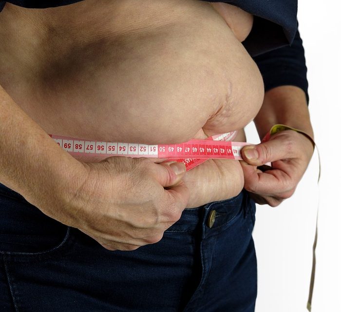 Obesidad: la revolución de combinar fármacos con cirugías Obesidad: la revolución de combinar fármacos con cirugías