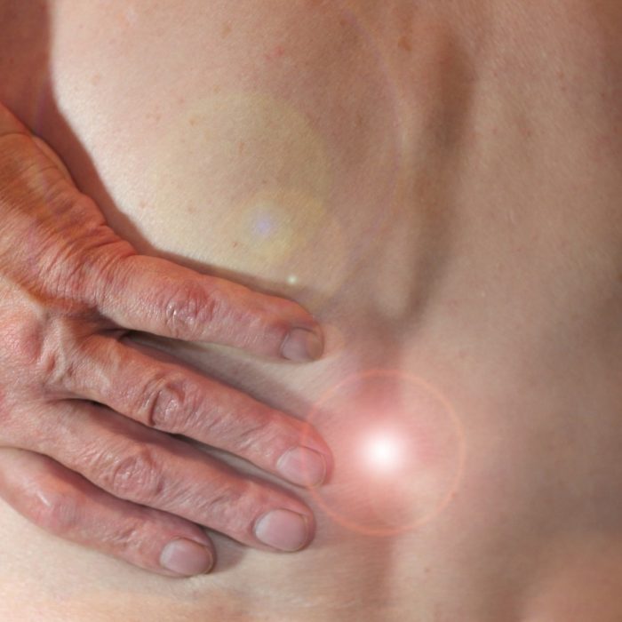 Lupus: qué es y cómo afecta la calidad de vida