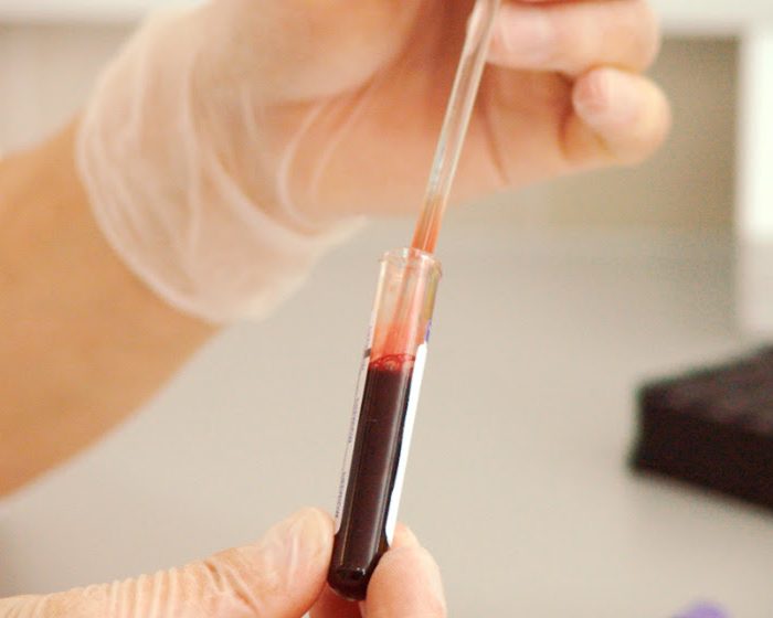 Un estudio sobre el sistema inmune de las personas con depresión abre el camino para diagnosticar la enfermedad a través de la sangre