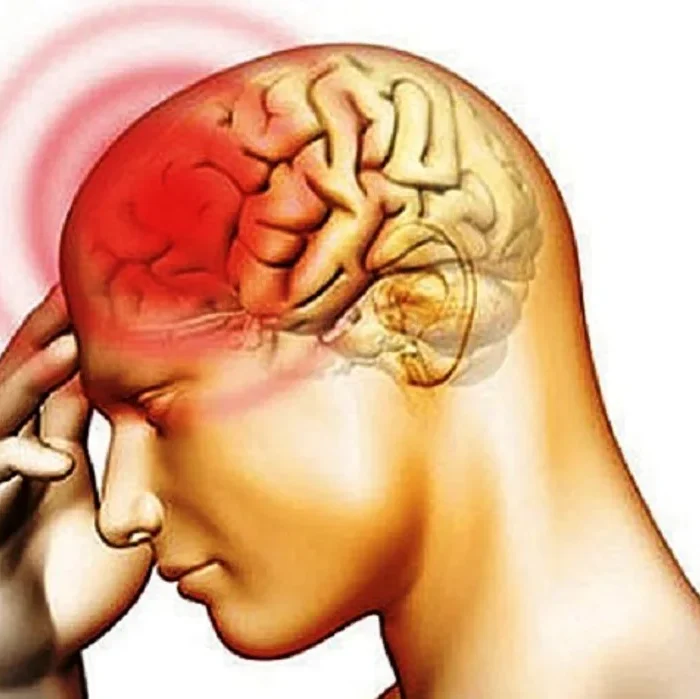 Meningitis: el virus que en la primavera aumenta la probabilidad de contagio