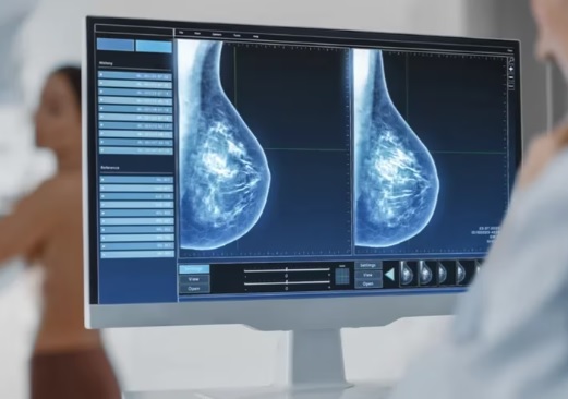 Cáncer de mama: la importancia de la detección temprana