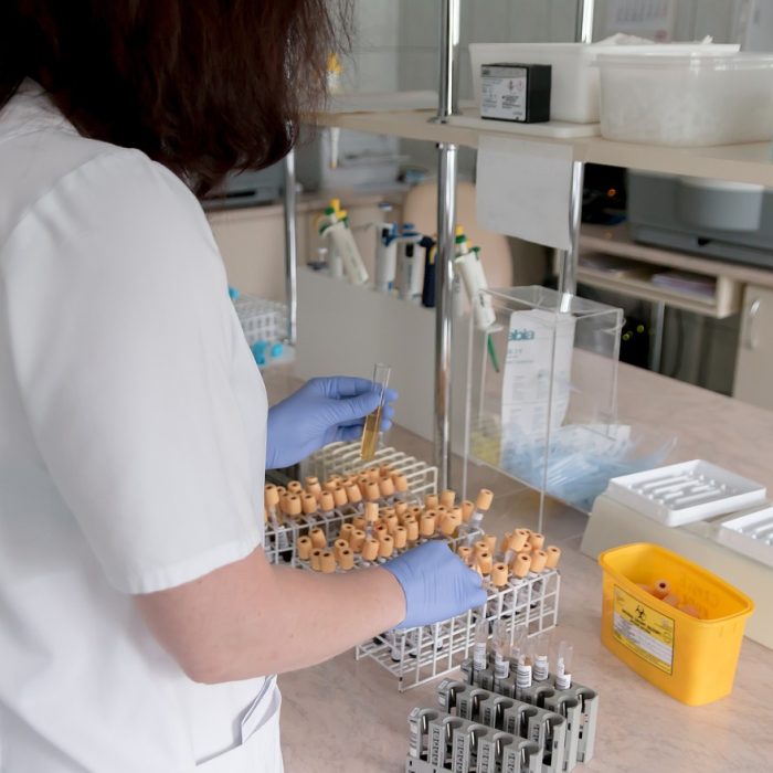 “El 70% de las decisiones médicas se basan en análisis de laboratorio”