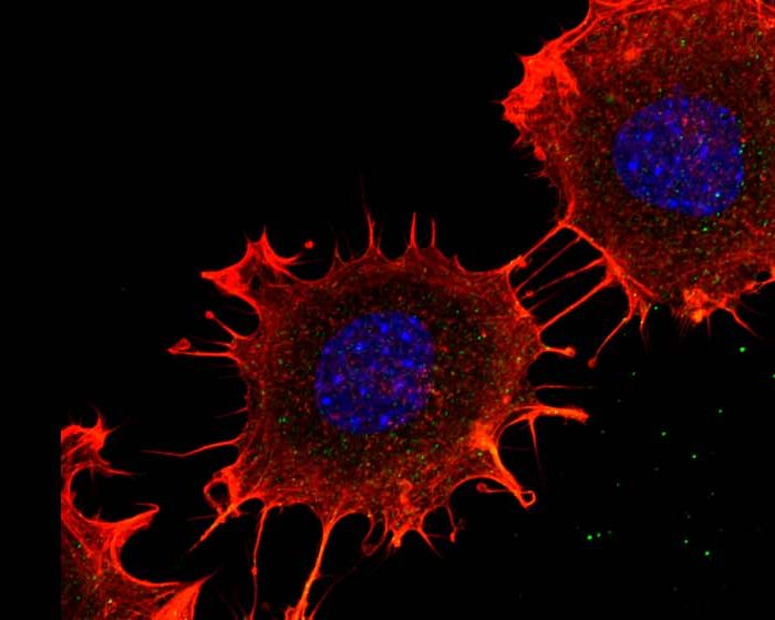 Estudian el rol de una proteína que podría ser clave para hallar una nueva terapia contra el cáncer de colon