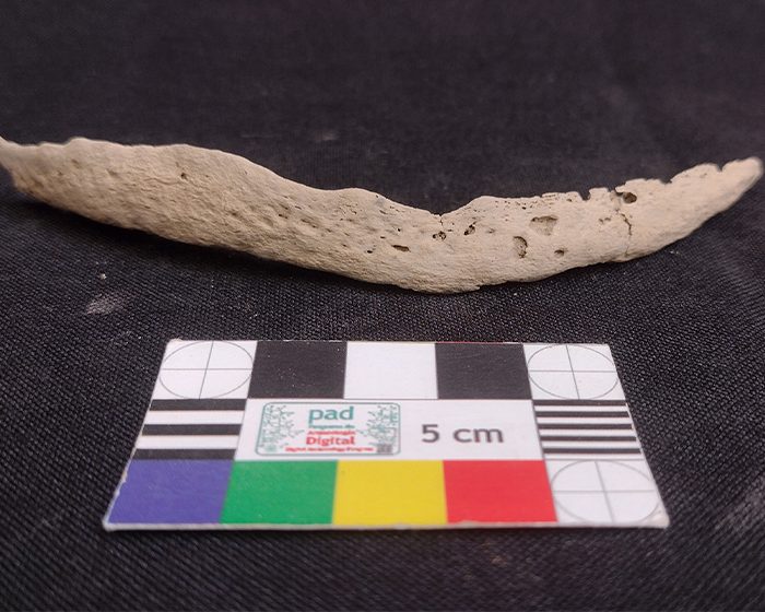 Revelan claves sobre el origen y la expansión de la sífilis en América y el resto del mundo