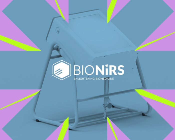 Bionirs: una empresa del CONICET dedicada a mejorar el diagnóstico del cáncer de mama