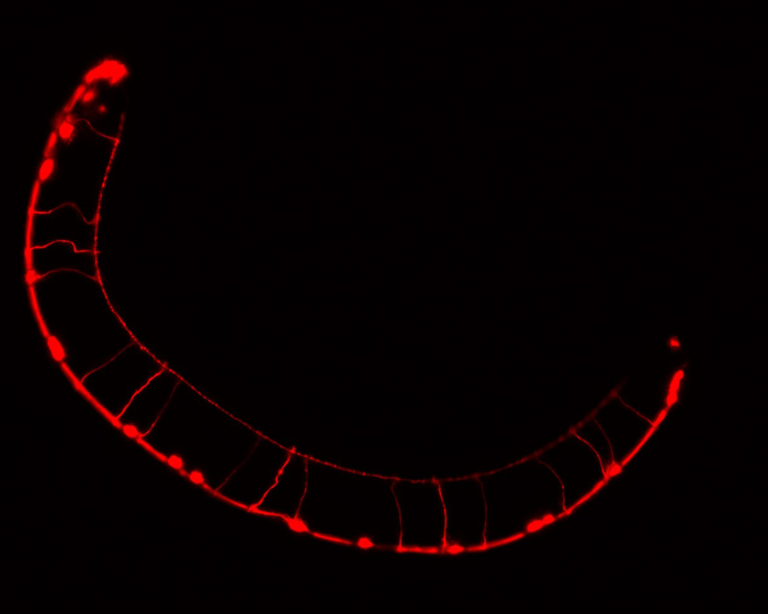 Identifican cómo se vinculan ciertas mutaciones genéticas con alteraciones del neurodesarrollo