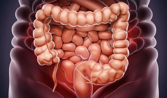 La colonoscopía asistida por IA aumenta la detección de pólipos y adenomas cancerosos