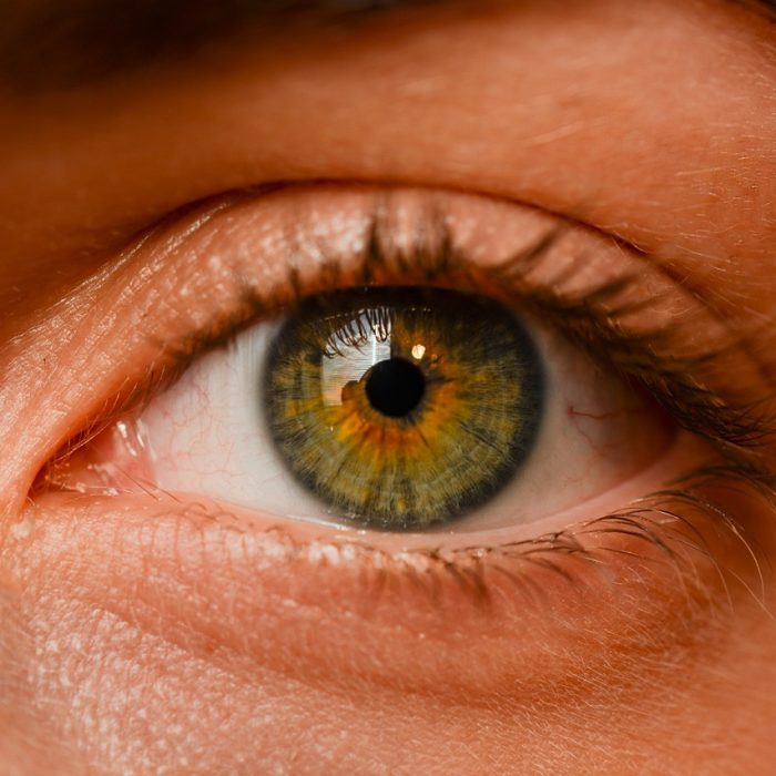 Más de un millón de personas padecen glaucoma en Argentina