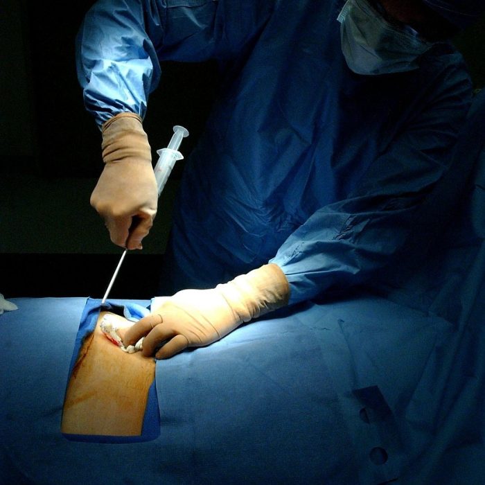 Crece el número de donantes de médula ósea en Argentina Crece el número de donantes de médula ósea en Argentina