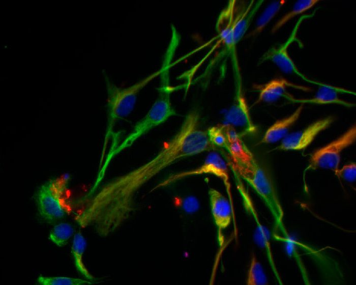 ExoMas: la empresa argentina de base tecnológica que apuesta a desarrollar una terapia de origen biológico contra la enfermedad de Parkinson