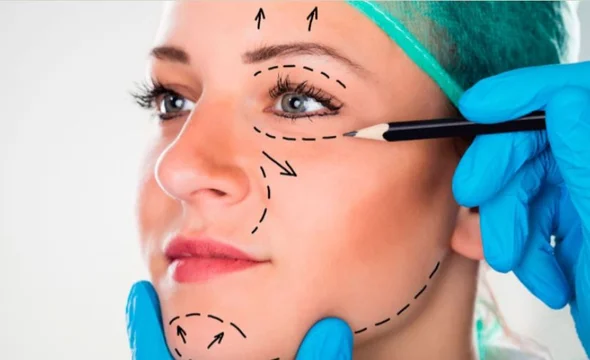 Afirman que creció “muchísimo” la cantidad de mujeres que cada vez más jóvenes se someten a cirugías faciales Afirman que creció “muchísimo” la cantidad de mujeres que cada vez más jóvenes se someten a cirugías faciales