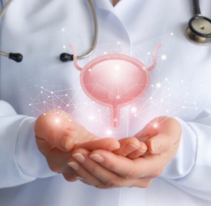 Cáncer de vejiga: especialistas recomiendan ponen énfasis en conocer los factores de riesgo