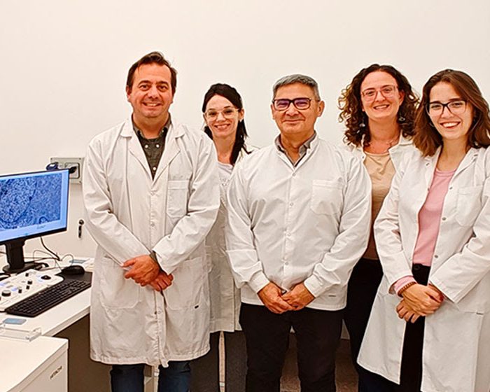 Descubren un nuevo blanco terapéutico para frenar el crecimiento de tumores intracraneales