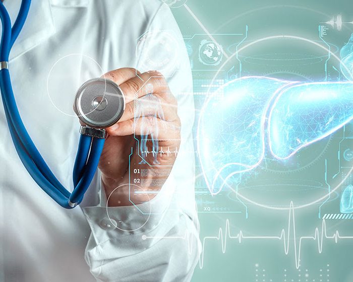 Identifican un biomarcador de riesgo sistémico en pacientes con la forma más frecuente de enfermedad hepática
