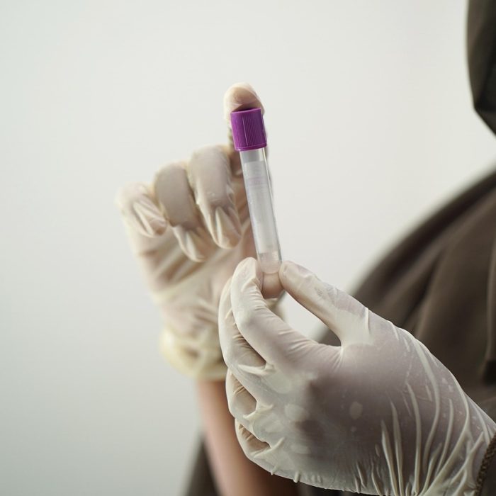 Nueva prueba de sangre de biopsia líquida para detectar cáncer