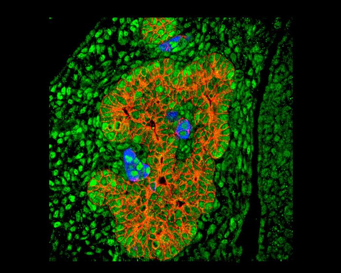 Diabetes tipo 1: nuevo hallazgo para generar células beta productoras de insulina con fines terapéuticos