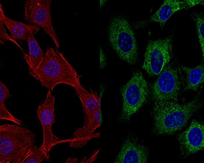 Diseñan estrategia para incrementar la eficacia de las inmunoterapias en pacientes con cáncer colorrectal