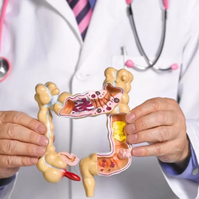 Una nueva droga demostró duplicar la sobrevida libre de progresión del cáncer de colon avanzado