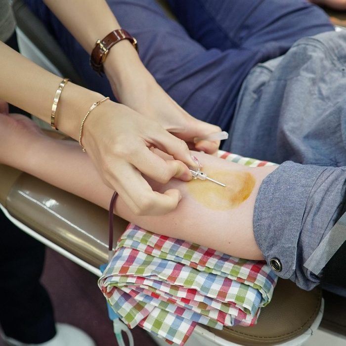 Linfoma: un cáncer hematológico que hoy tiene altas chances de curación Linfoma: un cáncer hematológico que hoy tiene altas chances de curación
