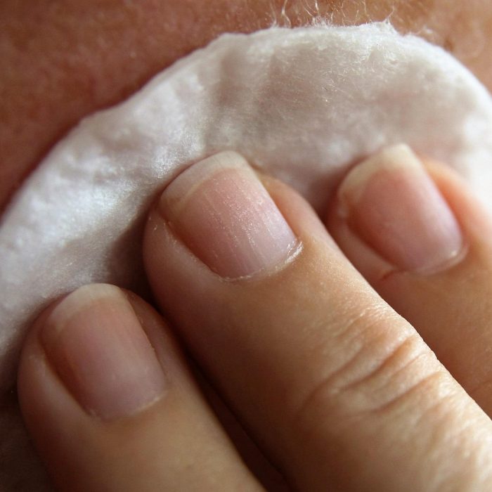 Dermatitis atópica, la enfermedad inflamatoria que afecta a entre el 10 y el 20% de los niños