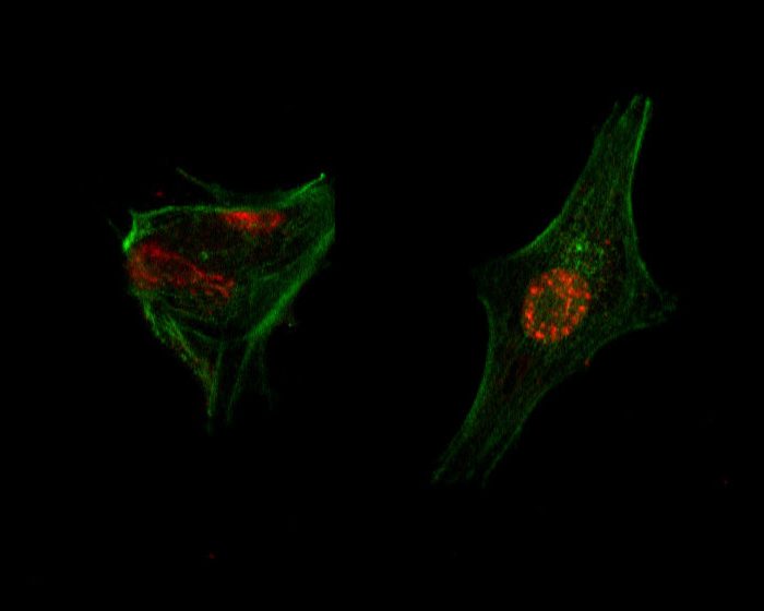 Estudio preclínico: con un enfoque pionero logran eliminar la metástasis de cáncer colorrectal