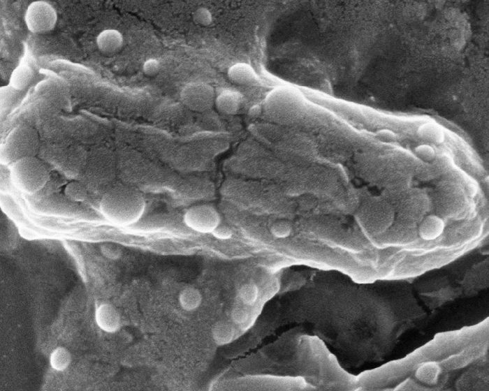 Nueva estrategia para eliminar bacterias multirresistentes